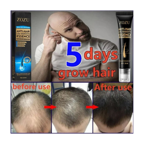 ESENCIA DE CRECIMIENTO RAPIDO DEL CABELLO